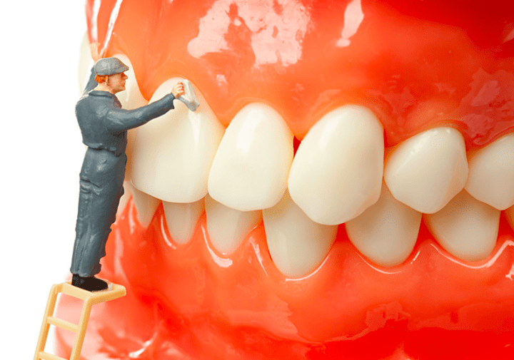 Periodontia - Tratamento de Gengiva